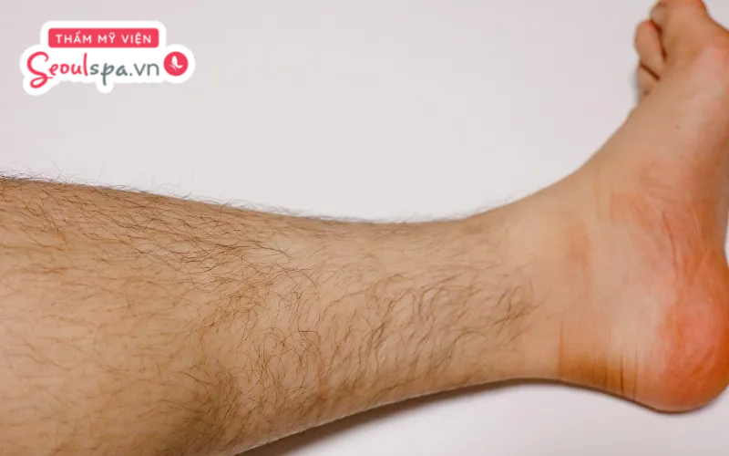 Lông chân mọc nhiều ở nam giới với nhiều đặc điểm khác nhau có thể ảnh hưởng đến tướng số