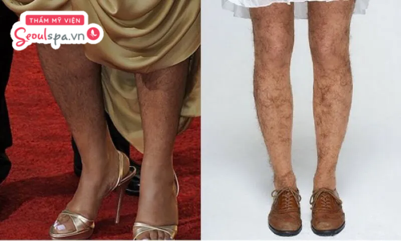 Nữ giới mọc lông chân nhiều thường gây ảnh hưởng nghiêm trọng đến tính thẩm mỹ, nhưng bù lại có tướng số khá tốt
