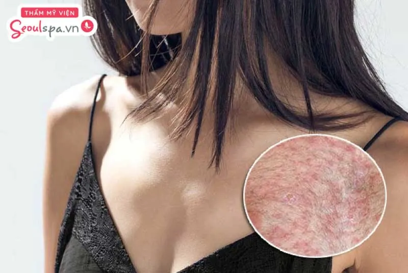 Nhổ lông ngực không ảnh hưởng gì đến vận mệnh nhưng nếu thực hiện sai cách có thể khiến ngực bị kích ứng, viêm nhiễm