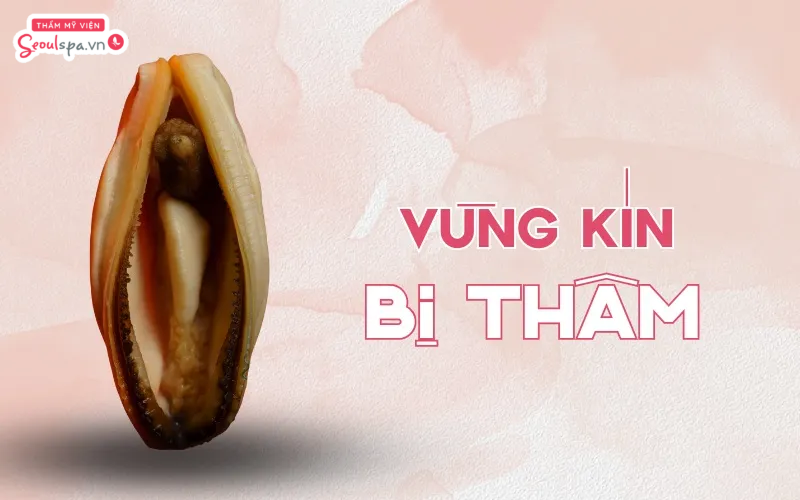 Thực hiện triệt lông sai cách khiến bề mặt da bị tổn thương là nguyên nhân phổ biến khiến triệt lông bikini bị thâm
