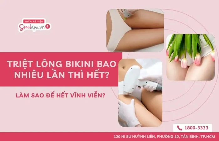 Triệt lông bikini mấy lần thì hết
