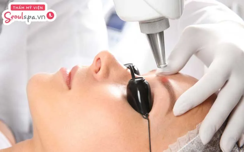 Triệt mày một phần và triệt mày bán phần được cho là cách giúp xử lý chân mày rậm rạp hiệu quả