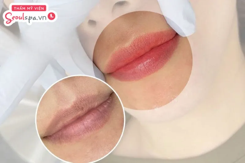 Thực hiện phun môi đúng cách giúp che phủ khuyết điểm môi thâm xỉn và các vết sẹo nhỏ trên môi