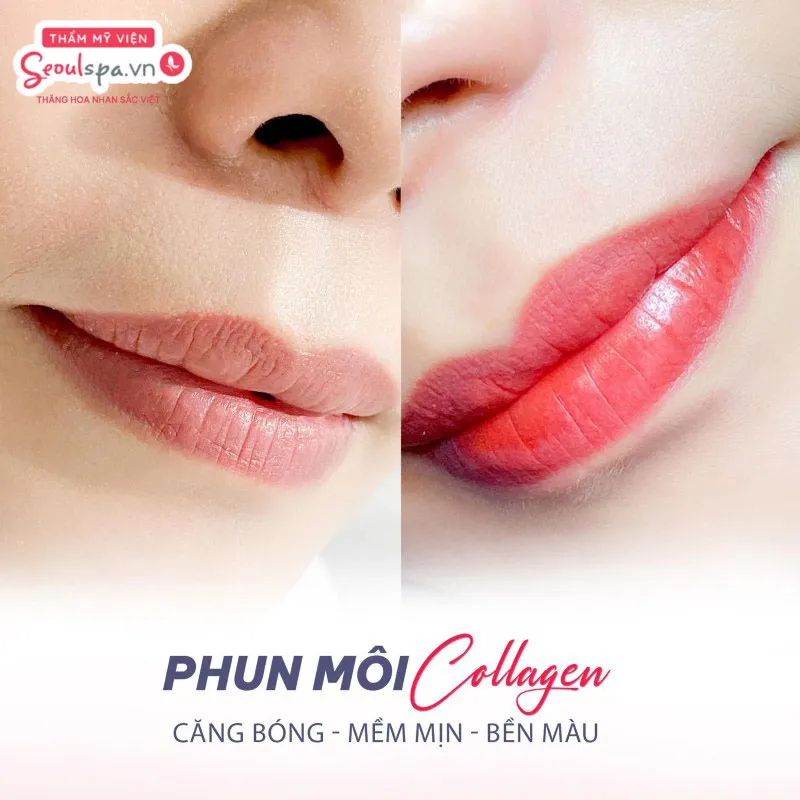 Phun môi Collagen là dịch vụ phun môi được nhiều người ưa chuộng và lựa chọn tại Thẩm mỹ viện SeoulSpa.Vn