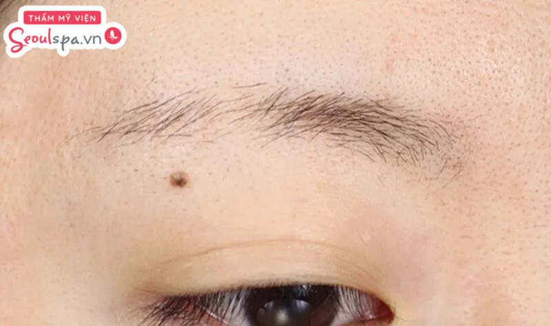 Người có lông mày thưa thớt, nhạt màu và mất cân đối có thể thực hiện phun lông mày nano