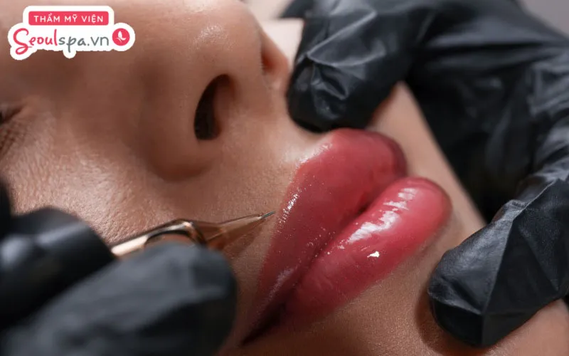 Quy trình phun môi Collagen phủ bóng cần được thực hiện đúng cách để tránh rủi ro viêm nhiễm ngoài ý muốn