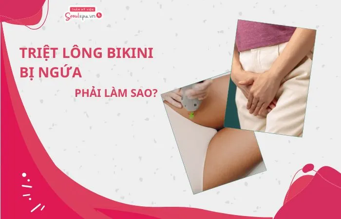 Triệt lông bikini bị ngứa