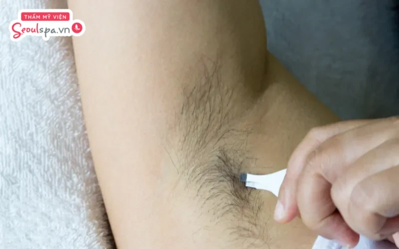 Bầu 3 tháng đầu có được nhổ lông nách không? Bầu có thể thực hiện nhổ lông nách nếu thực hiện đúng cách