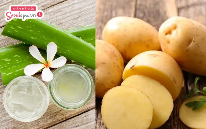 Hỗn hợp khoai tây nghiền và nha đam là cách triệt lông chân vĩnh viễn tại nhà cho nữ hiệu quả