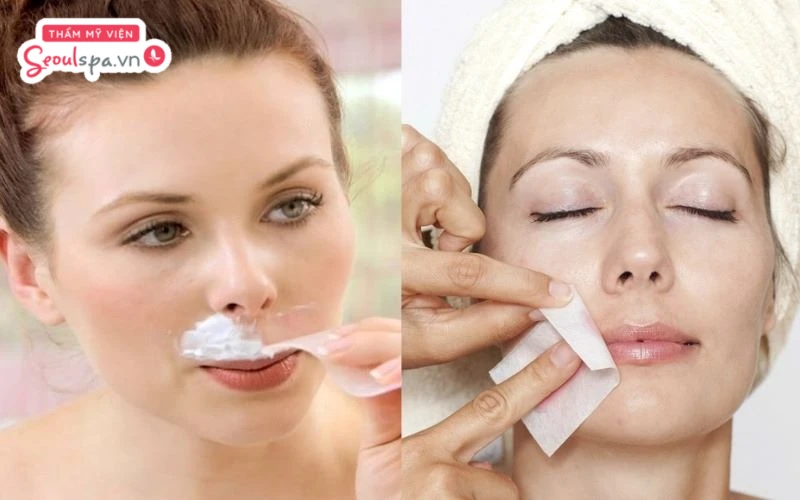 Sử dụng kem tẩy và sáp wax lông chuyên dụng là hai cách loại bỏ lông mặt an toàn với độ hiệu quả cao