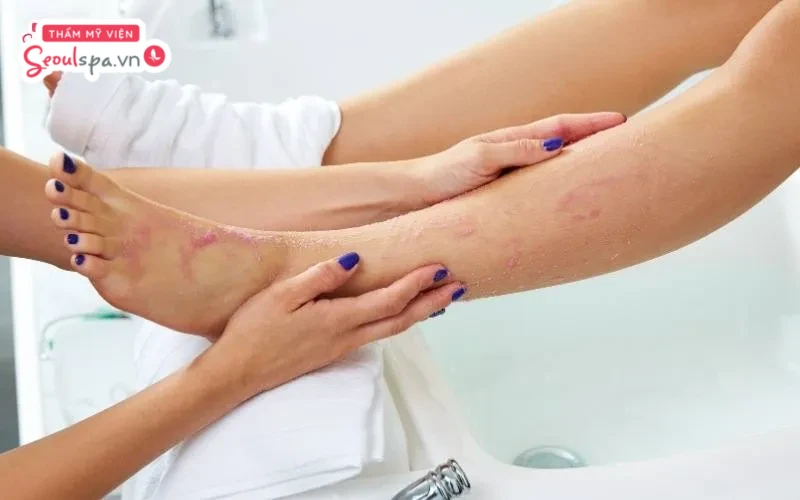 Tẩy tế bào chết chân trước khi thực hiện cạo lông chân sẽ giúp giảm thiểu nguy cơ viêm nhiễm trên da sau khi cạo