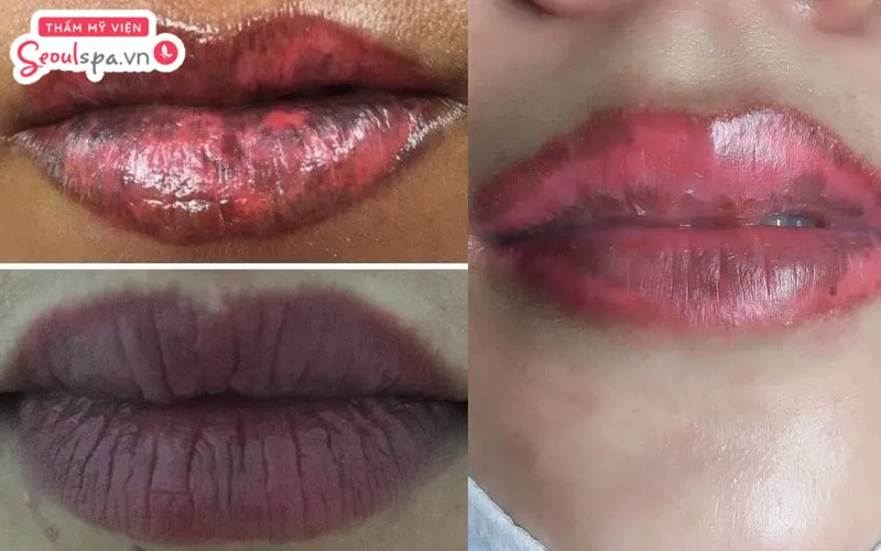 Môi lên màu không đều bị loang lổ là dấu hiệu phun môi bị hỏng thường gặp
