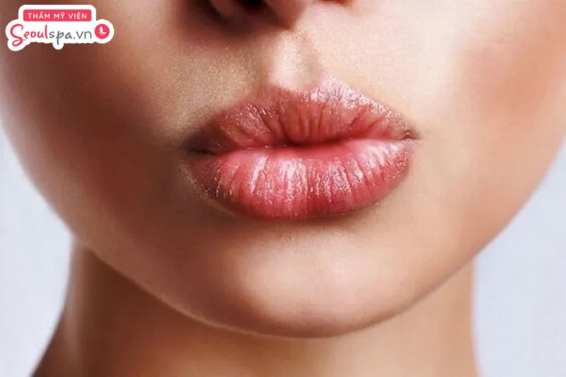 Tùy vào từng vấn đề môi đang gặp phải mà bạn có thể cân nhắc lựa chọn cách xử lý hiệu quả