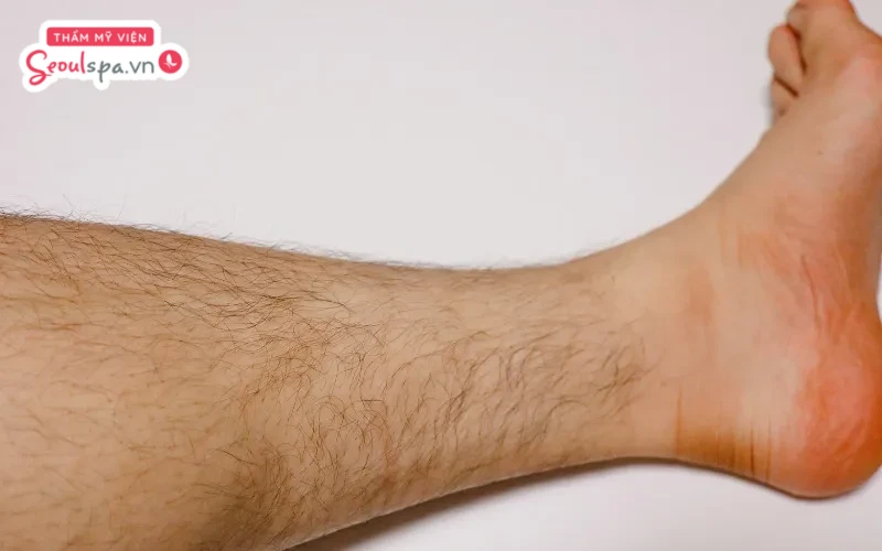 Lông chân mọc nhiều ở nam giới với nhiều đặc điểm khác nhau có thể ảnh hưởng đến tướng số