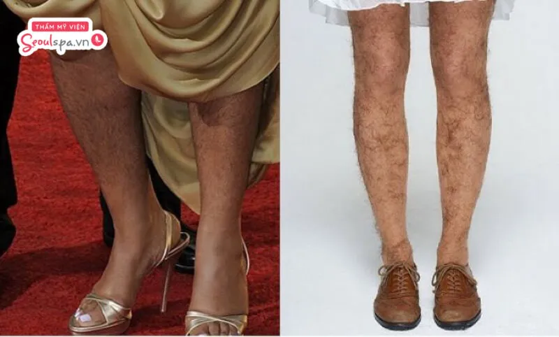 Nữ giới mọc lông chân nhiều thường gây ảnh hưởng nghiêm trọng đến tính thẩm mỹ, nhưng bù lại có tướng số khá tốt