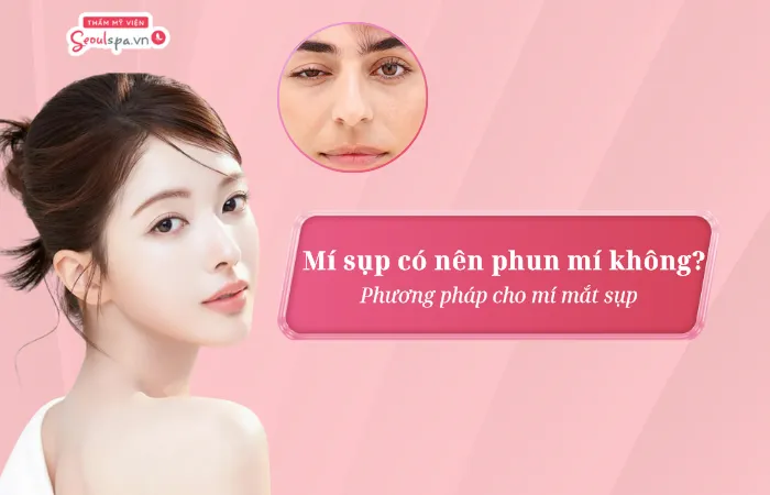 Mí sụp có nên phun mí không? Phương pháp cho mí mắt sụp