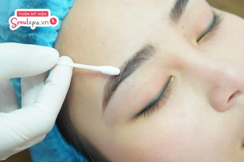 Sử dụng dung dịch xóa mực xăm là cách giúp loại bỏ sắc tố mực xăm tích tụ dưới da trước khi phun chân mày mới