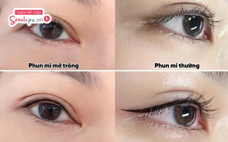 Nên chọn phun mí mở tròng hay phun mí thường còn tùy thuộc vào nhu cầu và sở thích của từng người