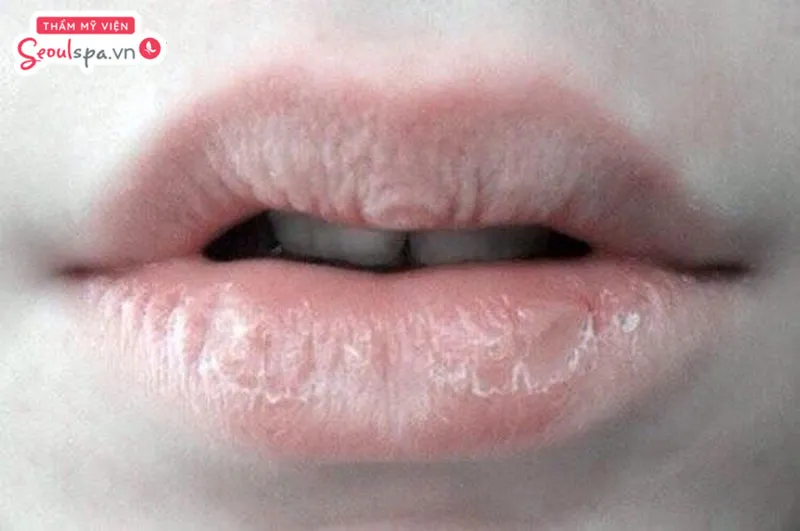 Môi sau phun loang lổ và lên màu không đều thường xuất phát từ nguyên nhân chủ yếu do nền môi gốc quá khô