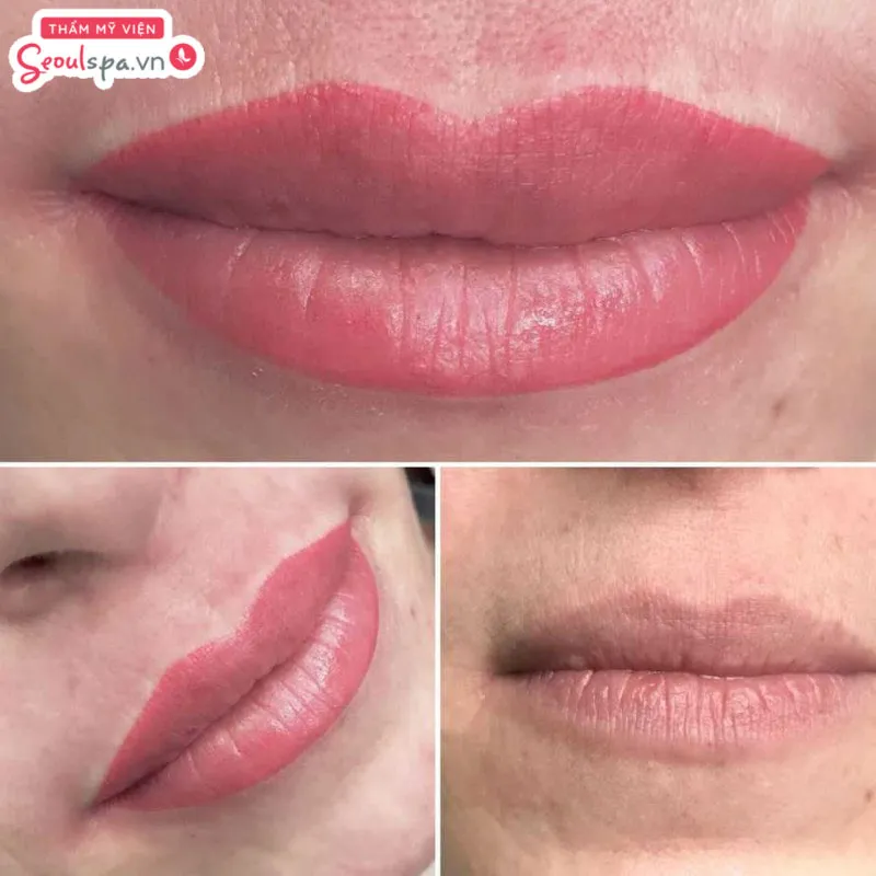 Việc lặp lại tần suất phun lại môi quá liên tục có thể khiến môi khó có thể trở lại trình trạng ban đầu