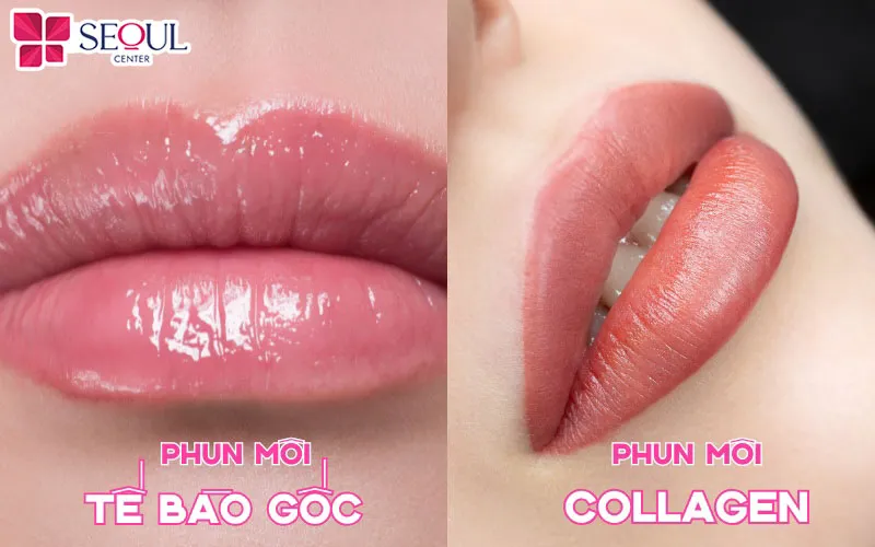 Nên phun xăm môi tế bào gốc hay Collagen còn tùy thuộc vào nhu cầu, tình trạng môi và sở thích của từng người