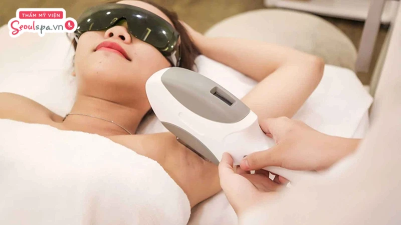 Thực hiện kiêng cữ sau triệt lông đúng cách đóng vai trò quan trọng giúp da nhanh phục hồi và tránh viêm nhiễm