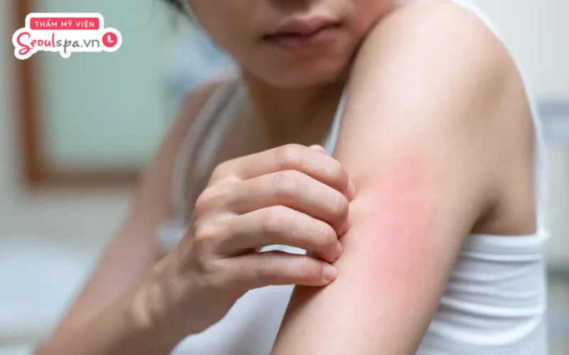 Không thực hiện gãi hoặc tác động mạnh lên bề mặt da sau khi triệt lông để ngăn ngừa nguy cơ da bị tổn thương