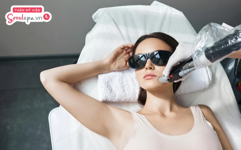 Triệt lông mặt thường đem lại hiệu quả loại bỏ lông rõ rệt chỉ sau 6 - 10 buổi triệt 