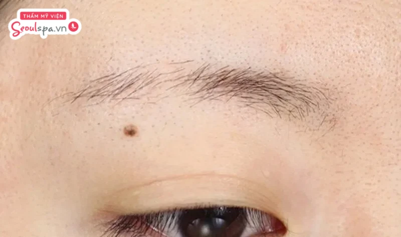 Lông mày không có khuôn, thưa thớt và kém gọn gàng là một trong những trường hợp nên ưu tiên triệt lông mày thừa
