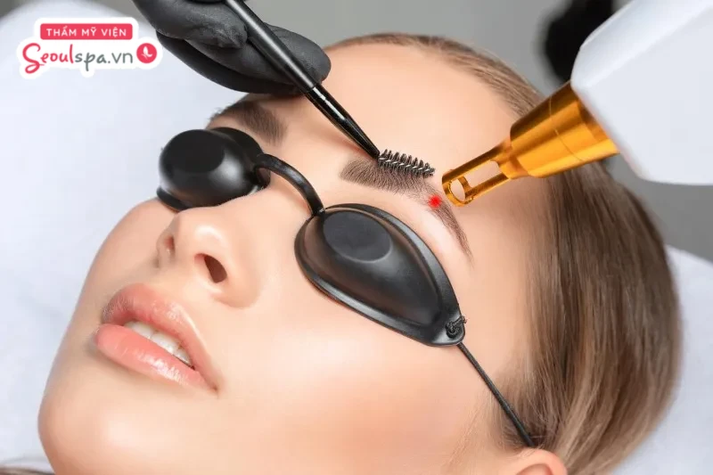 Triệt lông mày toàn phần là xu hướng làm đẹp giúp loại bỏ hoàn toàn lông trên chân mày và kết hợp phun xăm chân mày mới