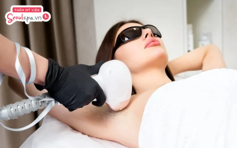 Triệt lông nách công nghệ cao có thể giảm thâm nách một phần nhưng không khử thâm triệt để