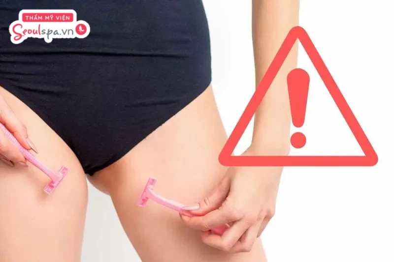 Không thực hiện cạo nhổ lông vùng kín trước 3 - 5 ngày vì dễ khiến Laser khó nhận diện nang lông và ảnh hưởng hiệu quả triệt