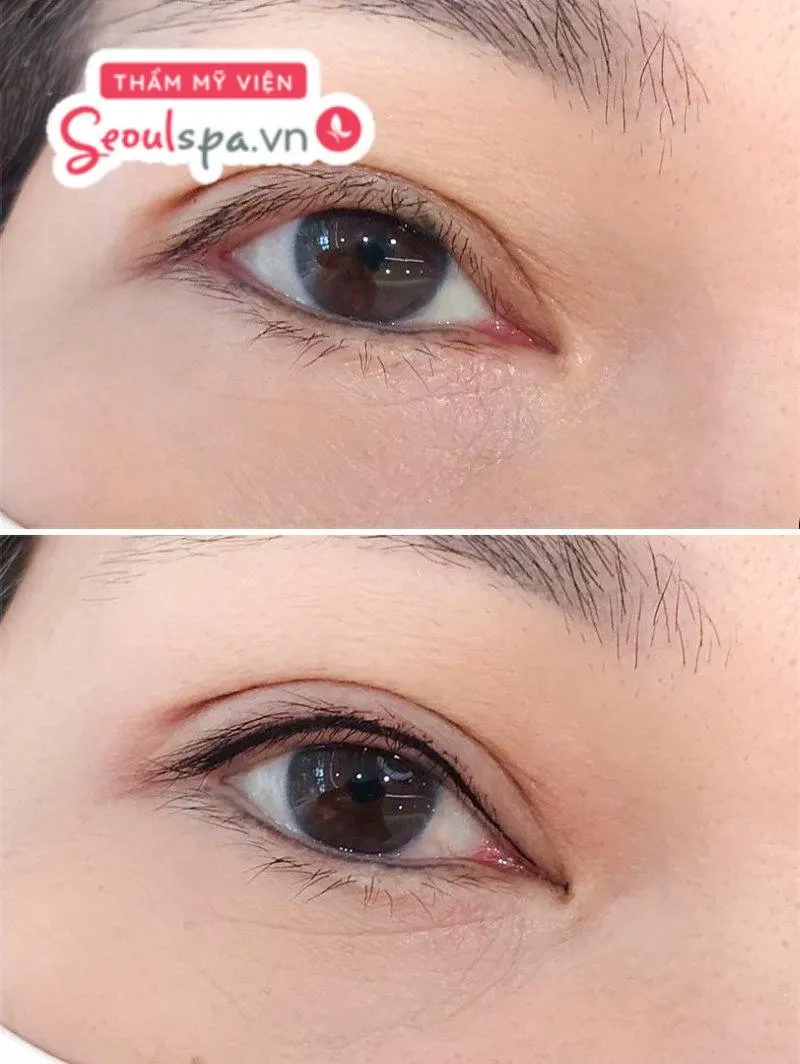 Phun mí mở tròng giúp tạo hiệu ứng mở rộng tròng mắt và giúp mắt trở nên nổi bật hơn