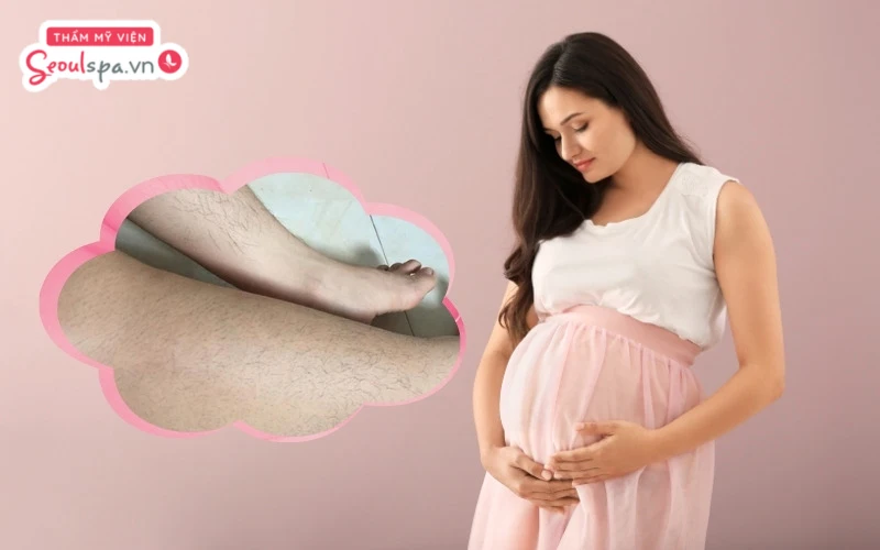 Mẹ bầu thường mọc nhiều lông trong giai đoạn mang thai vì ảnh hưởng từ nội tiết tố cũng như thói quen ăn uống mỗi ngày