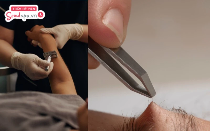 Sử dụng dao cạo và nhíp nhổ lông là hai cách loại bỏ lông bằng dụng cụ chuyên dụng giúp loại bỏ lông tức thì