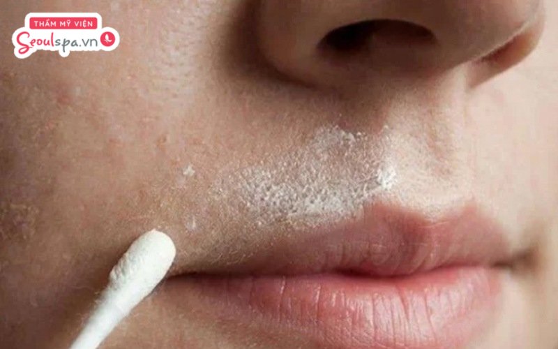 Thực hiện các bước tẩy ria mép bằng oxy già đúng cách giúp loại bỏ vùng lông mọc quanh mép miệng hiệu quả