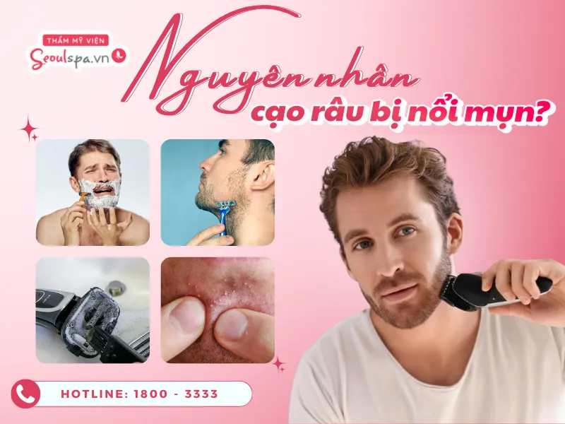 Cạo râu bị nổi mụn