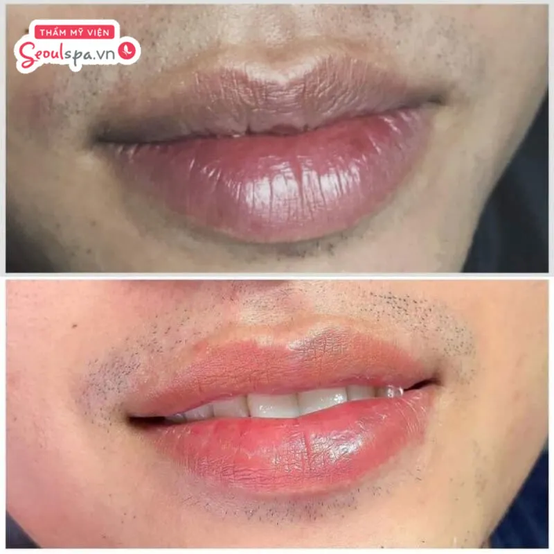 Màu sắc môi tươi tắn, hồng hào giúp cánh mày râu tăng sự tự tin trong giao tiếp hằng ngày