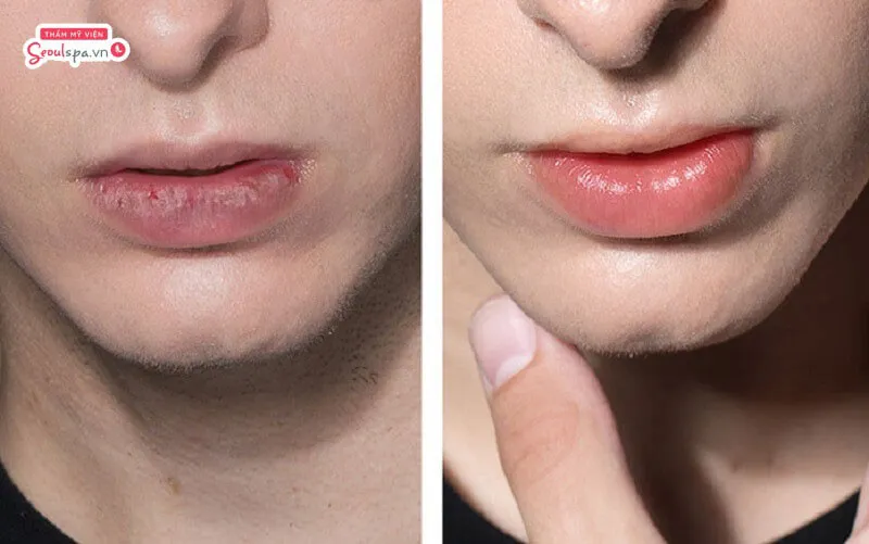 Hồng baby là tone màu đẹp cho nam giới giúp khắc phục khuyết điểm môi tối màu một cách hiệu quả