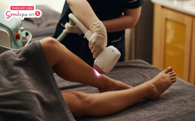 Triệt lông nửa phần chân được biết đến là phương pháp loại bỏ lông từ gối trở xuống hoặc trở lên tùy theo nhu cầu mỗi người