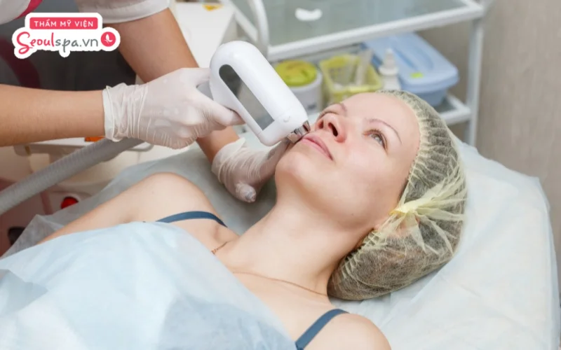 Phụ nữ nên thực hiện triệt ria mép nếu cảm thấy lông mọc quanh miệng quá rậm rạp và ảnh hưởng tính thẩm mỹ