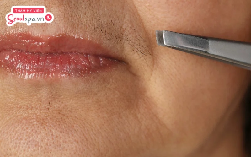 Nhíp được đánh giá là phương pháp phù hợp để loại bỏ từng sợi lông mỏng mọc thưa gây ảnh hưởng tính thẩm mỹ