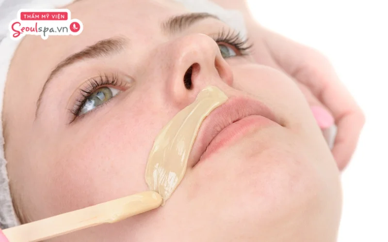 Wax lông bằng sáp nóng đem lại hiệu quả loại bỏ lông ria mép tận gốc nhưng dễ tiềm ẩn nguy cơ đau rát, tổn thương da