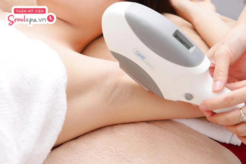 Triệt lông nách bằng công nghệ cao