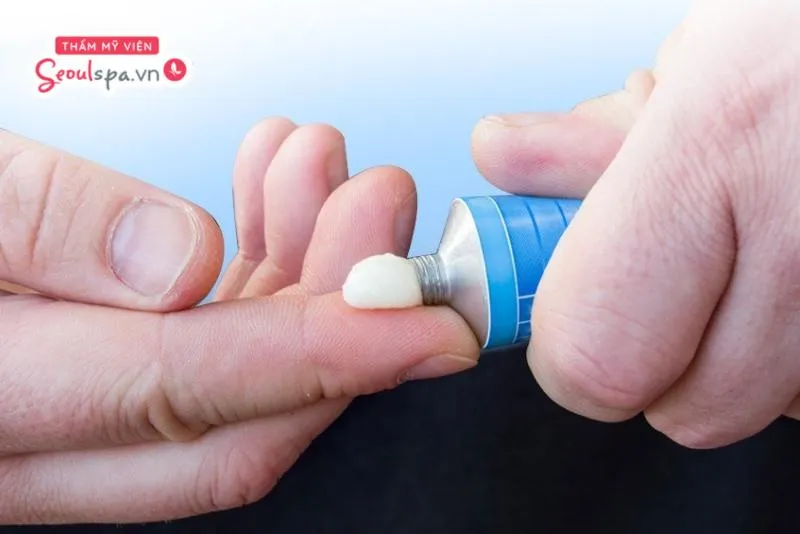 Bôi thuốc Corticosteroid đúng chỉ định bác sĩ là cách điều trị giảm viêm các bệnh lý da liễu vùng chân mày