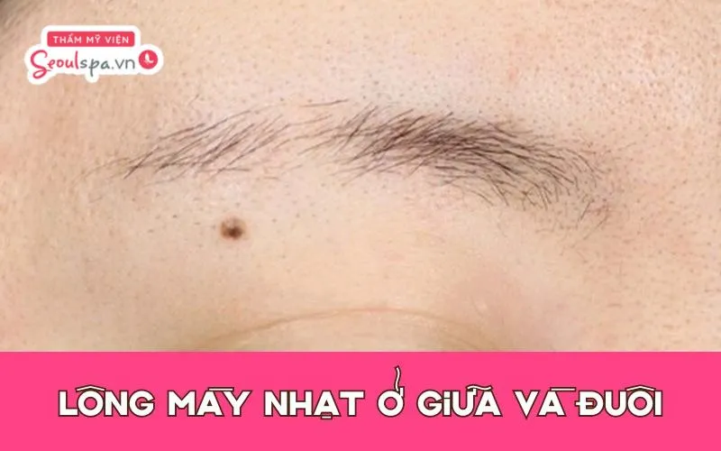 Chân mày nhạt ở giữa và đuôi mày thường dễ dàng phân biệt khiến sợi mày chỉ tập trung ở đầu chân mày