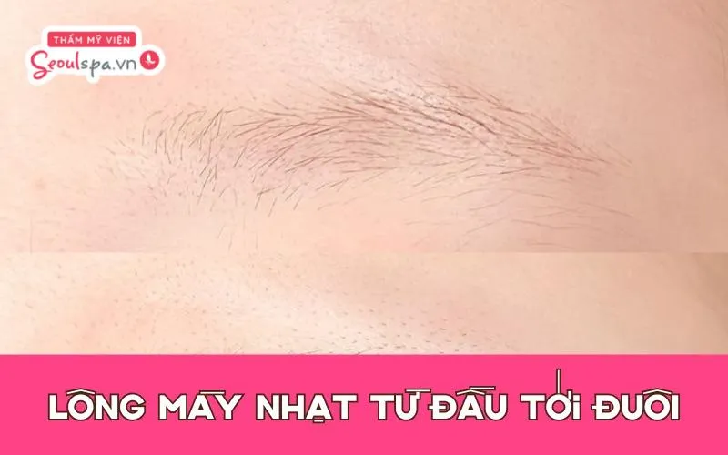 Lông mày thưa và nhạt dần từ đầu tới đuôi thường có các sợi chân mày đều sáng màu và khó nhìn rõ trên khuôn mặt