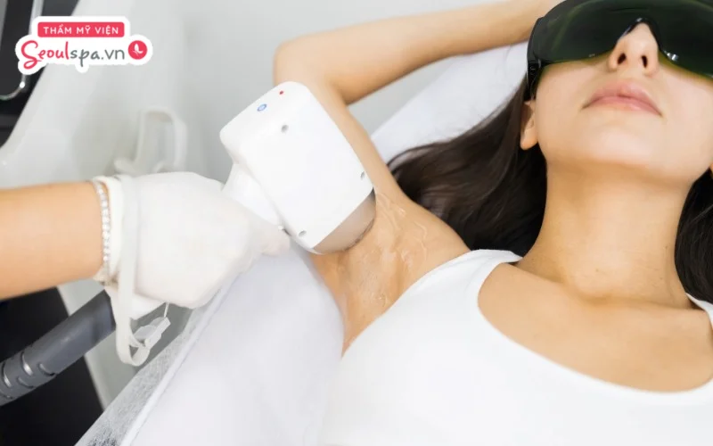 Triệt lông bằng công nghệ IPL thường không để lại cảm giác quá đau rát hoặc khó chịu trên da trong quá trình thực hiện