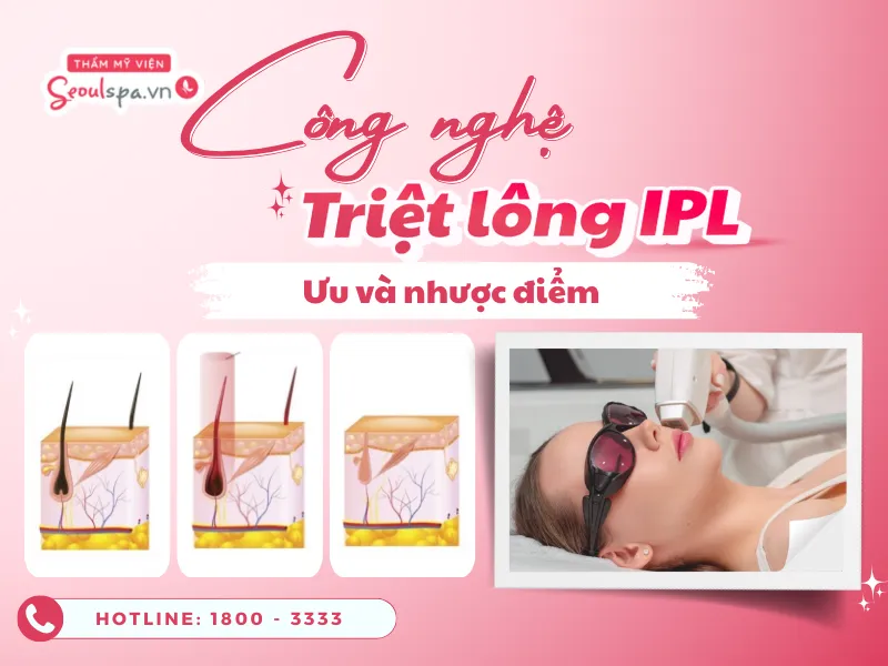 Triệt lông ipl