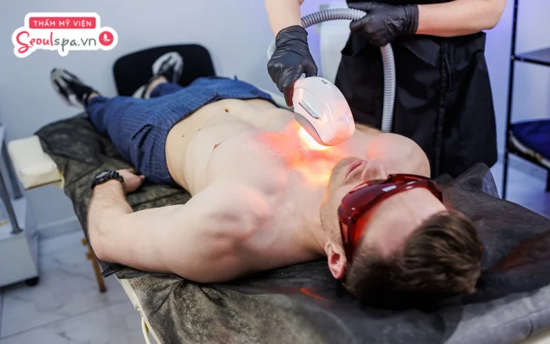 IPL là công nghệ triệt lông phổ biến được ứng dụng rộng rãi tại các spa giúp tác động tận gốc nang lông và loại bỏ lông hiệu quả